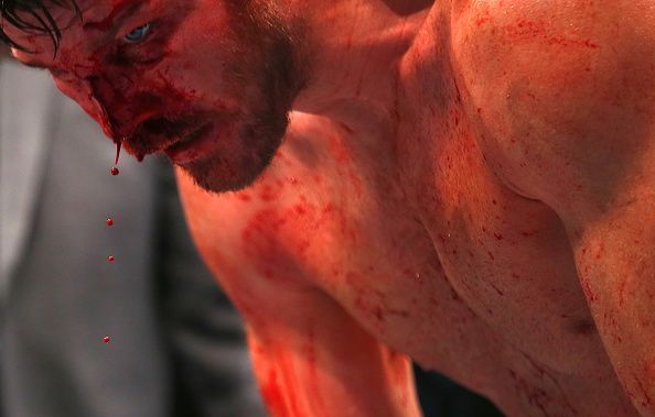 10 of the worst injuries in MMA history