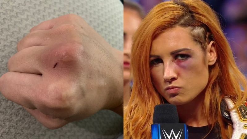 Becky Lynch was on the receiving end of a thunderous punch from Nia Jax last year