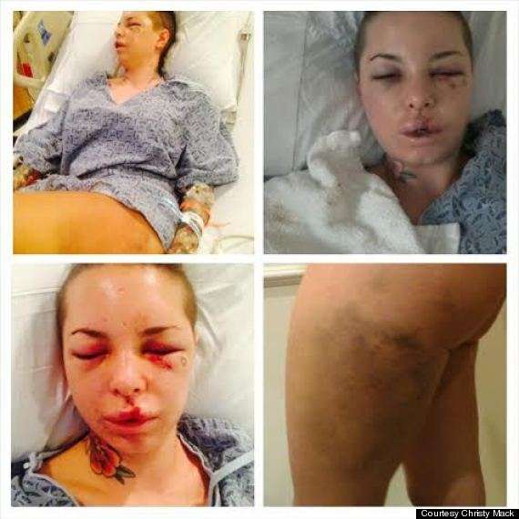 MMA News Christy Mack Allegedly Assaulted An